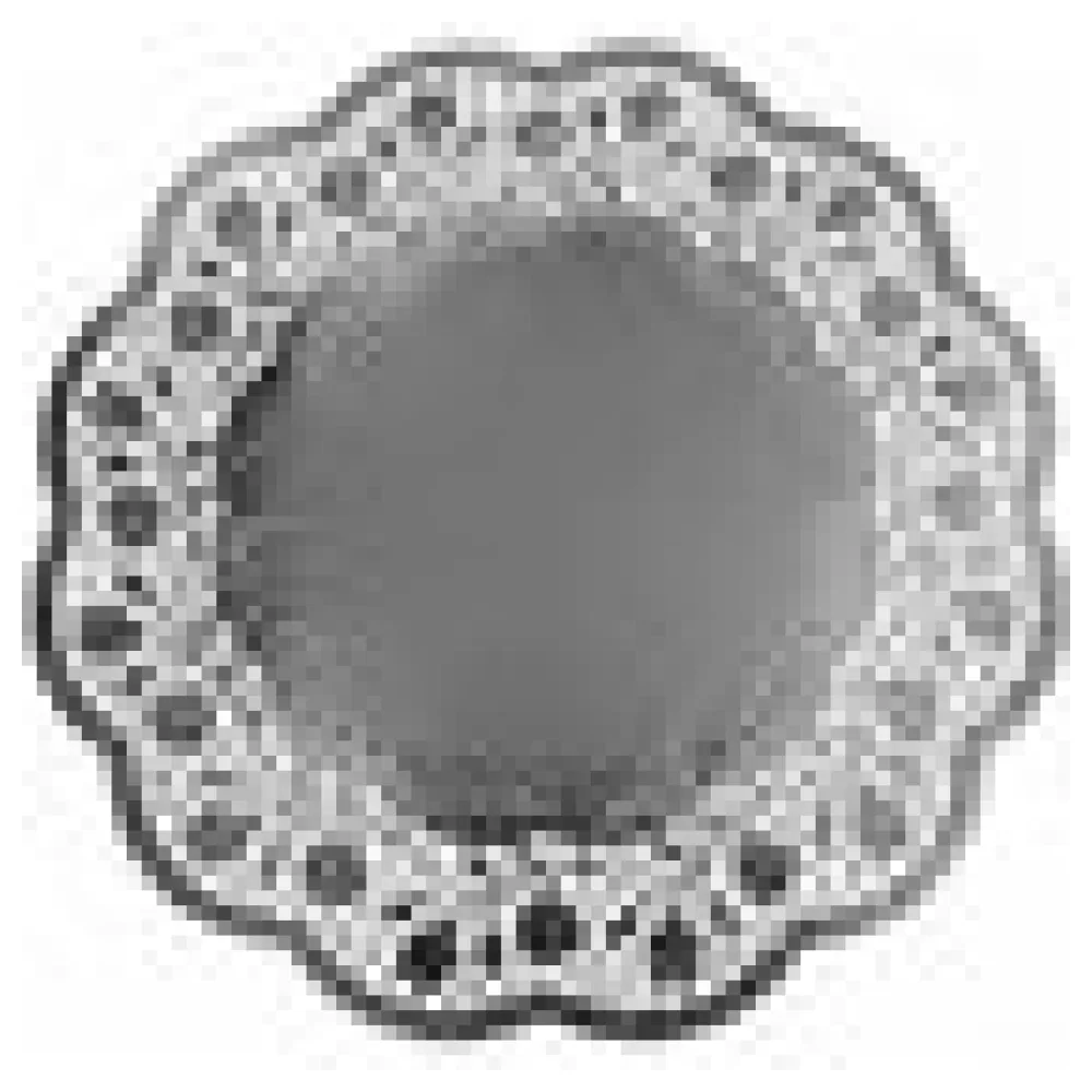 Deko-Tortenspitzen rund silber O 32 cm, 4 Stk. – Bild 4